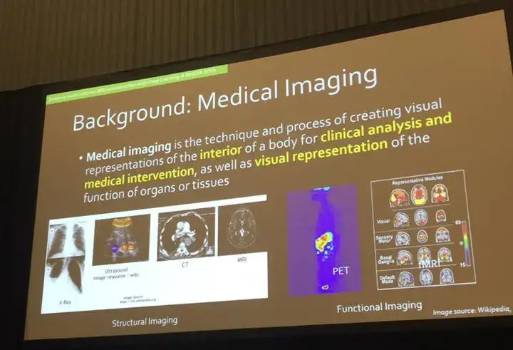 This slide, like the picture below from InferVision (Chinese startup) are common with Indian and Chinese startups creating new interfaces generating reports (noting AI predictions) on the medical images.